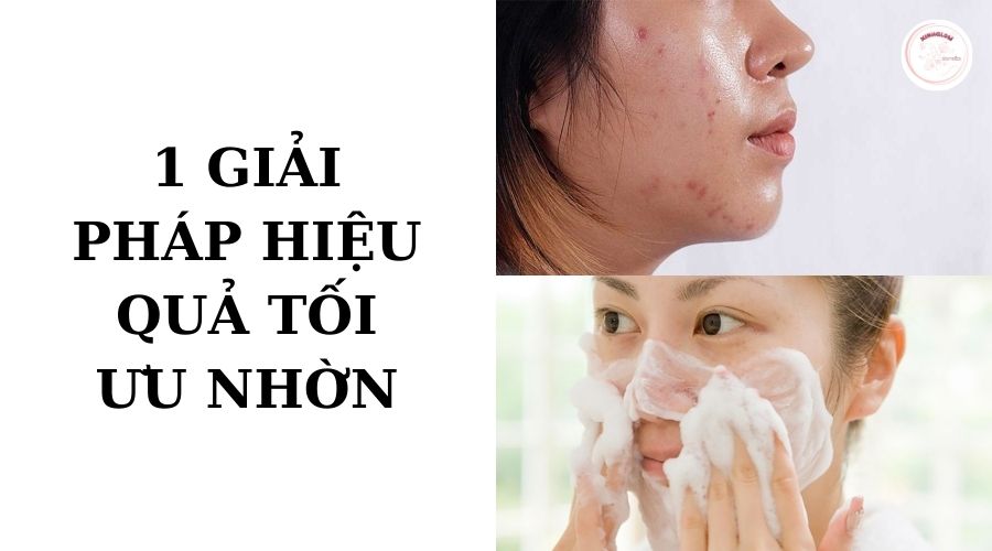 1-giải-pháp-hiệu-quả-tối-ưu-nhờn