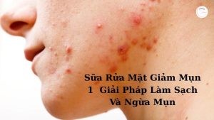 Sữa Rửa Mặt Giảm Mụn –1 Giải Pháp Làm Sạch Và Ngừa Mụn