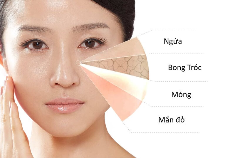 Tác hại của nước tẩy trang có thể khiến da nổi mụn, kích ứng, khô ráp nếu dùng sai cách. Cùng tìm hiểu nguyên nhân và cách khắc phục hiệu quả!
