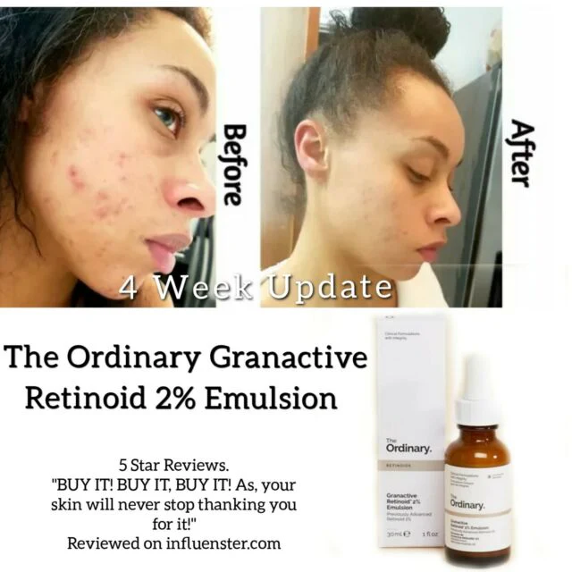 The Ordinary Granactive Retinoid 2% Emulsion